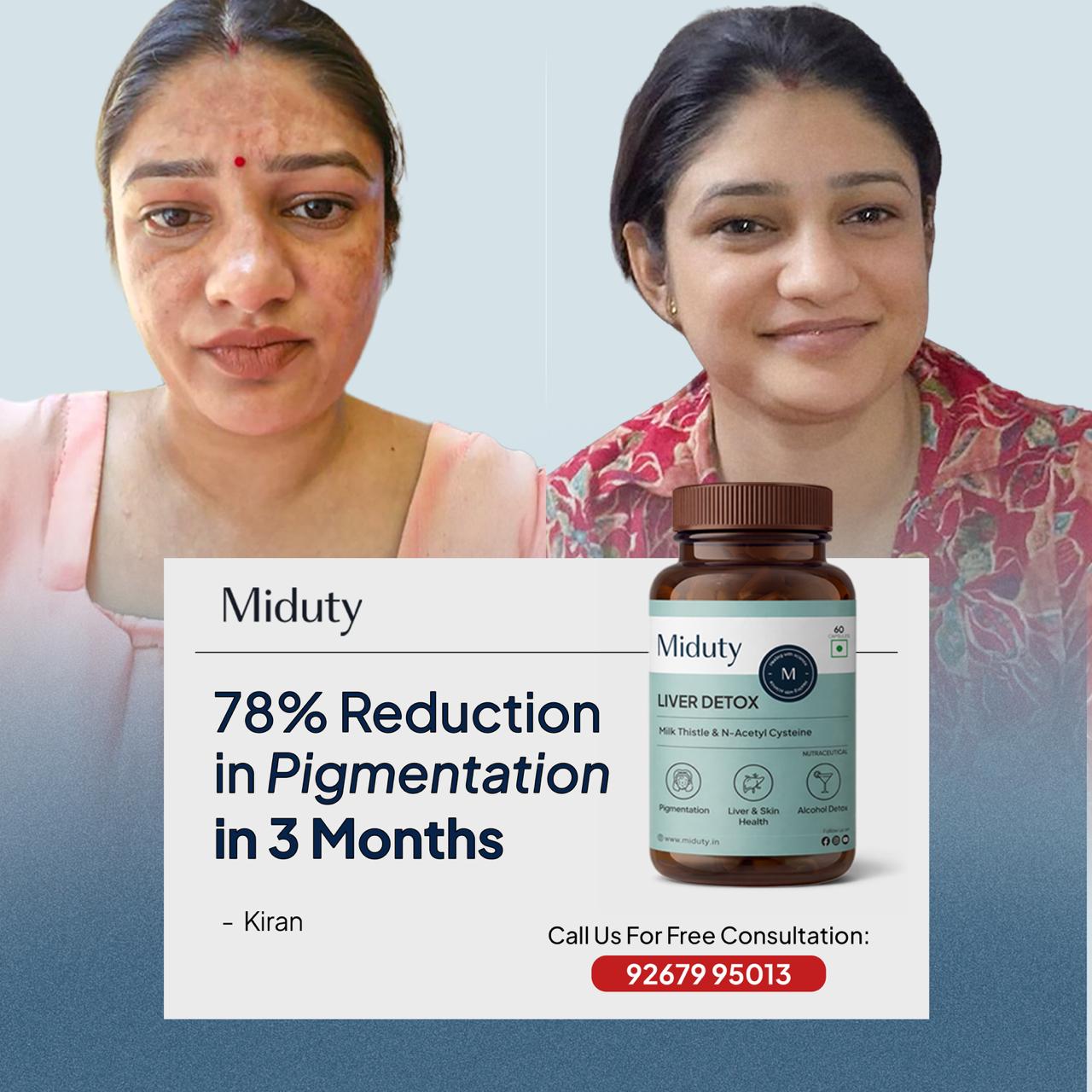 Miduty Facebook ad