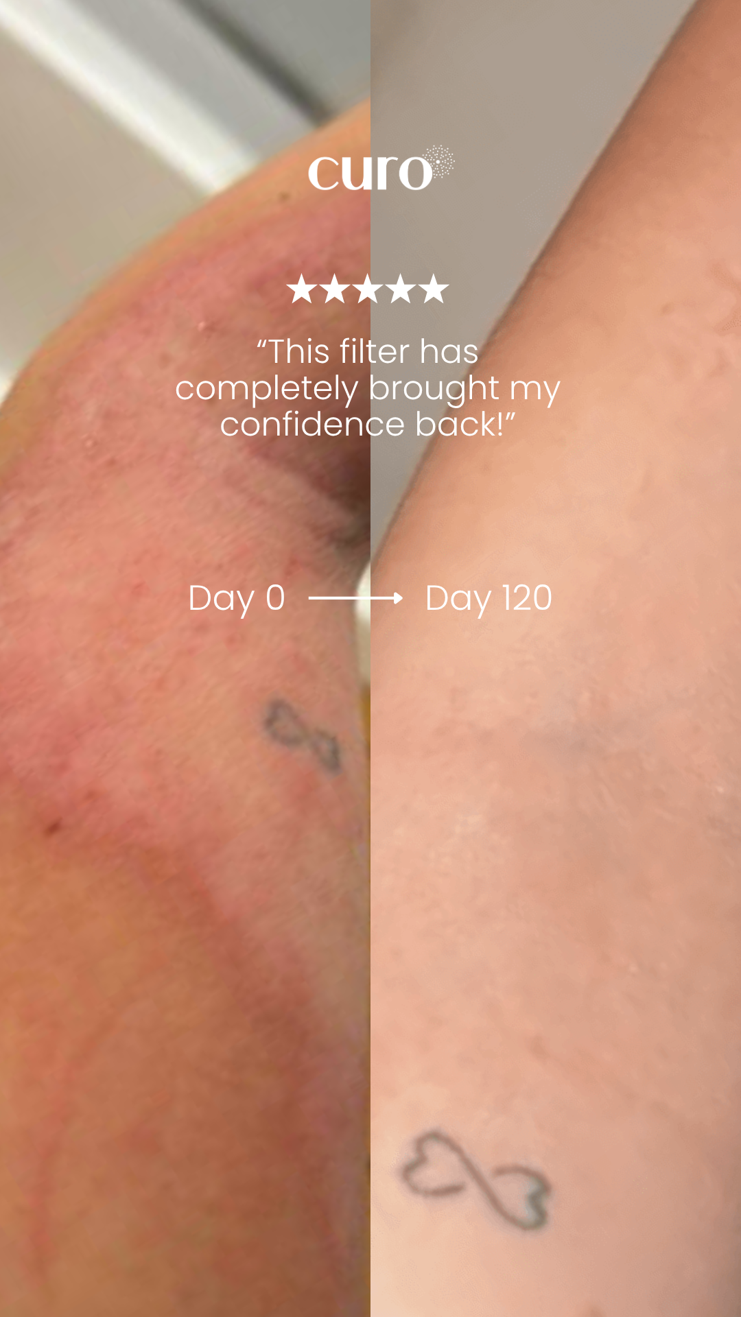 Curo Skin Facebook ad