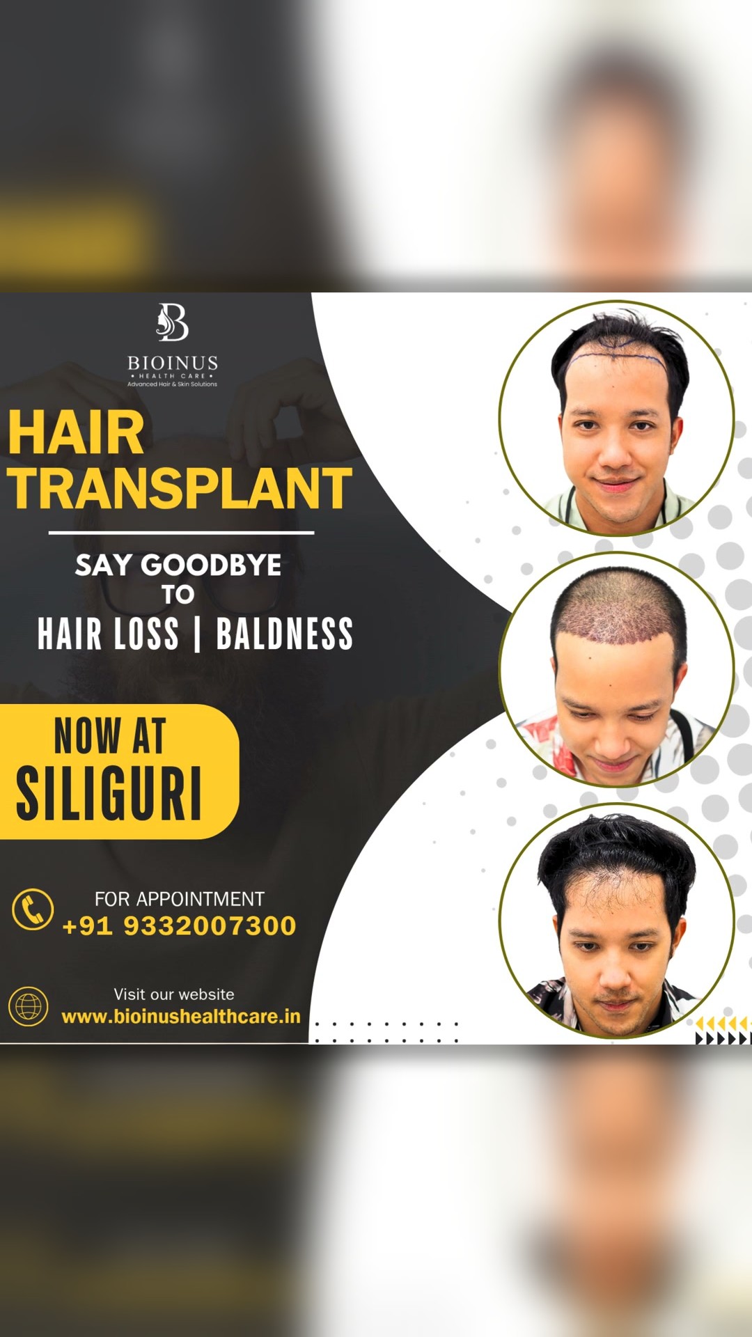 Bioinus Healthcare Advanced Hair & Skin Solutions, Siliguri Facebook ad