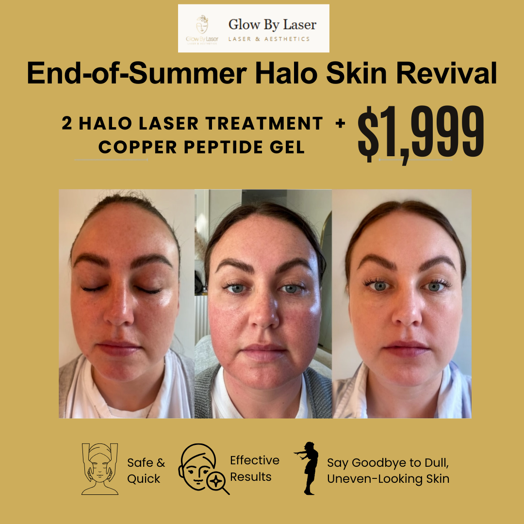 Glow By Laser Facebook ad: End of Summer Halo Skin Revival
