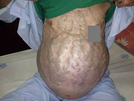 Dr. Micheal Jones Facebook ad
