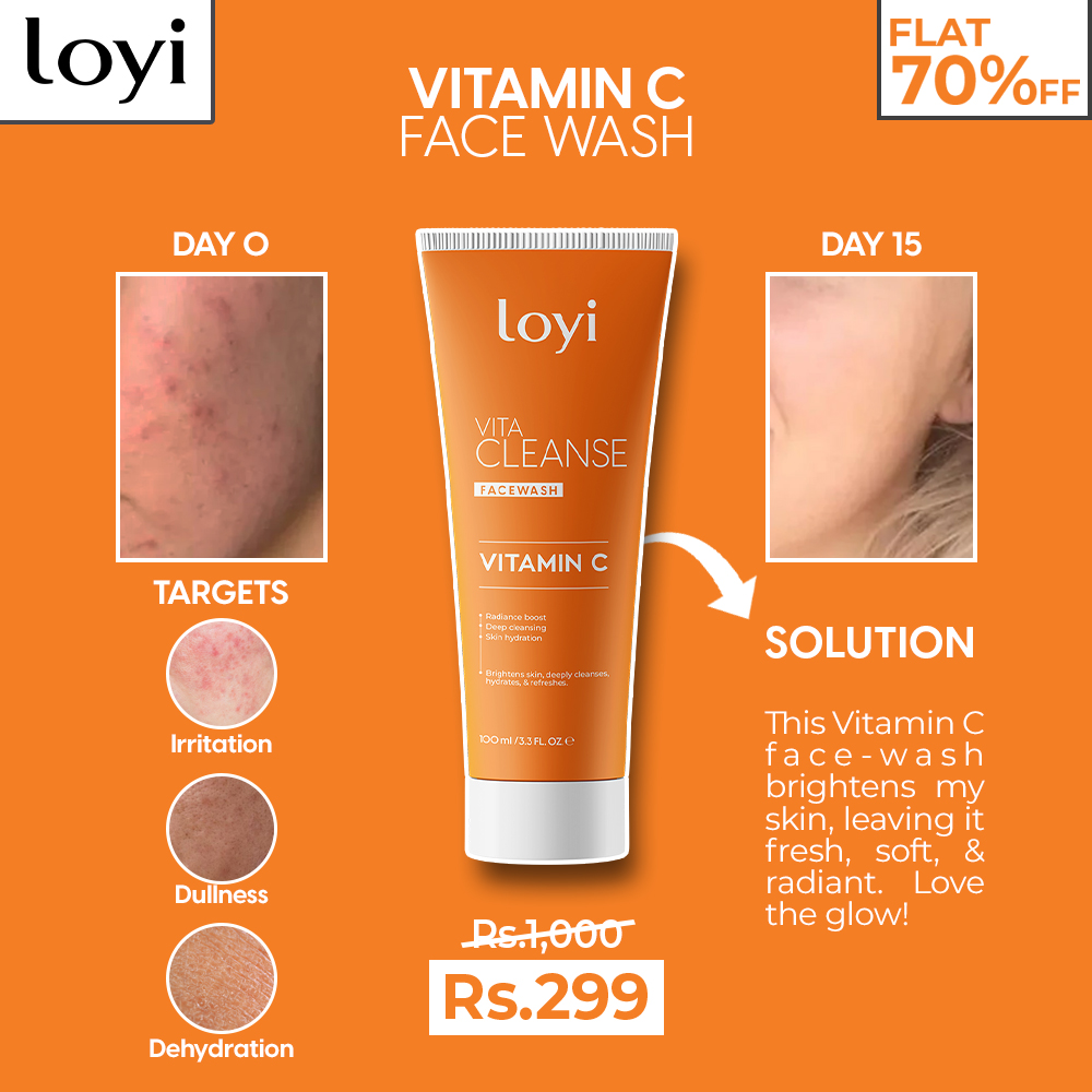 Loyi Facebook ad