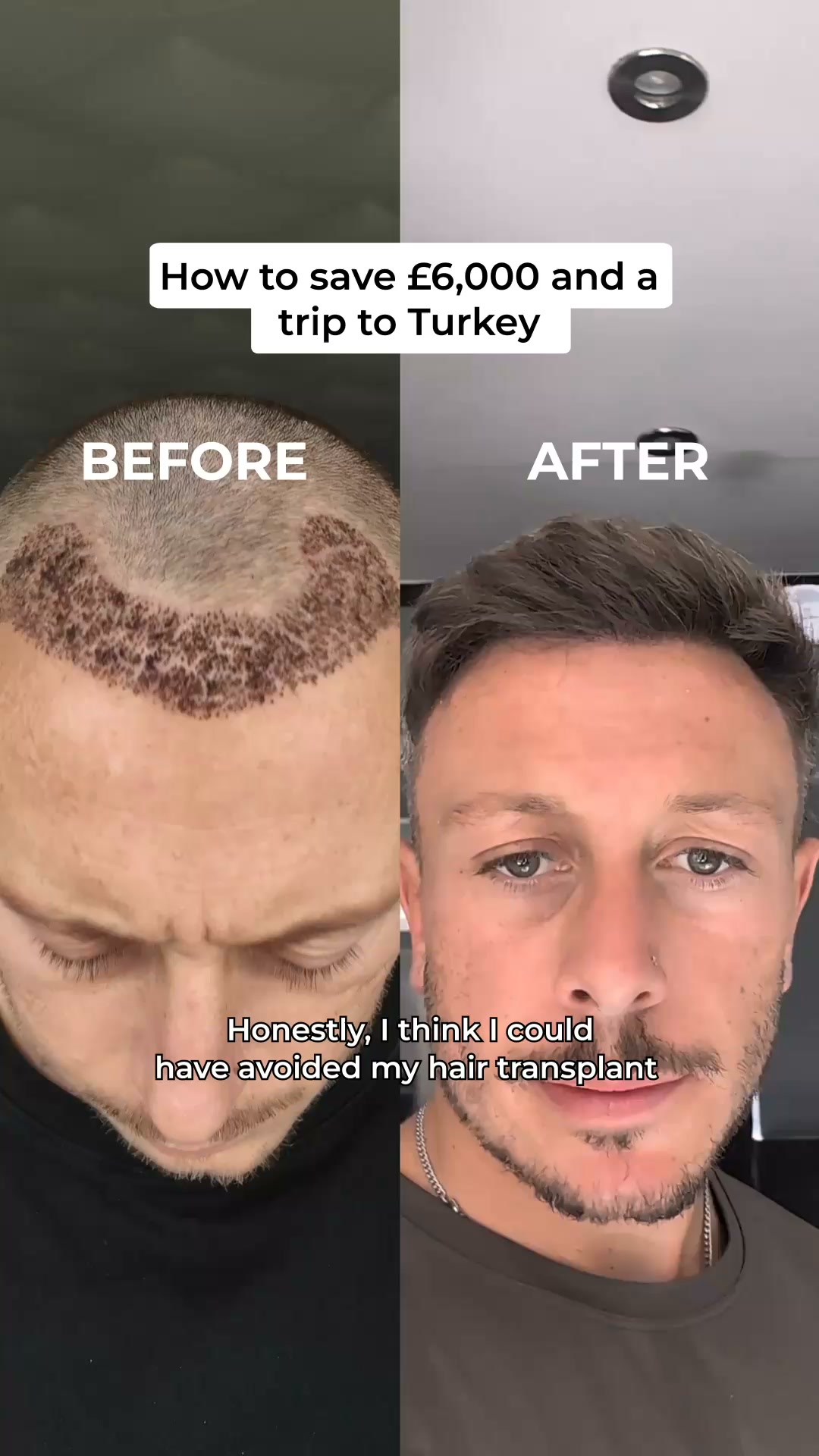 hims Facebook ad: Hair loss treatment, minus the hassle