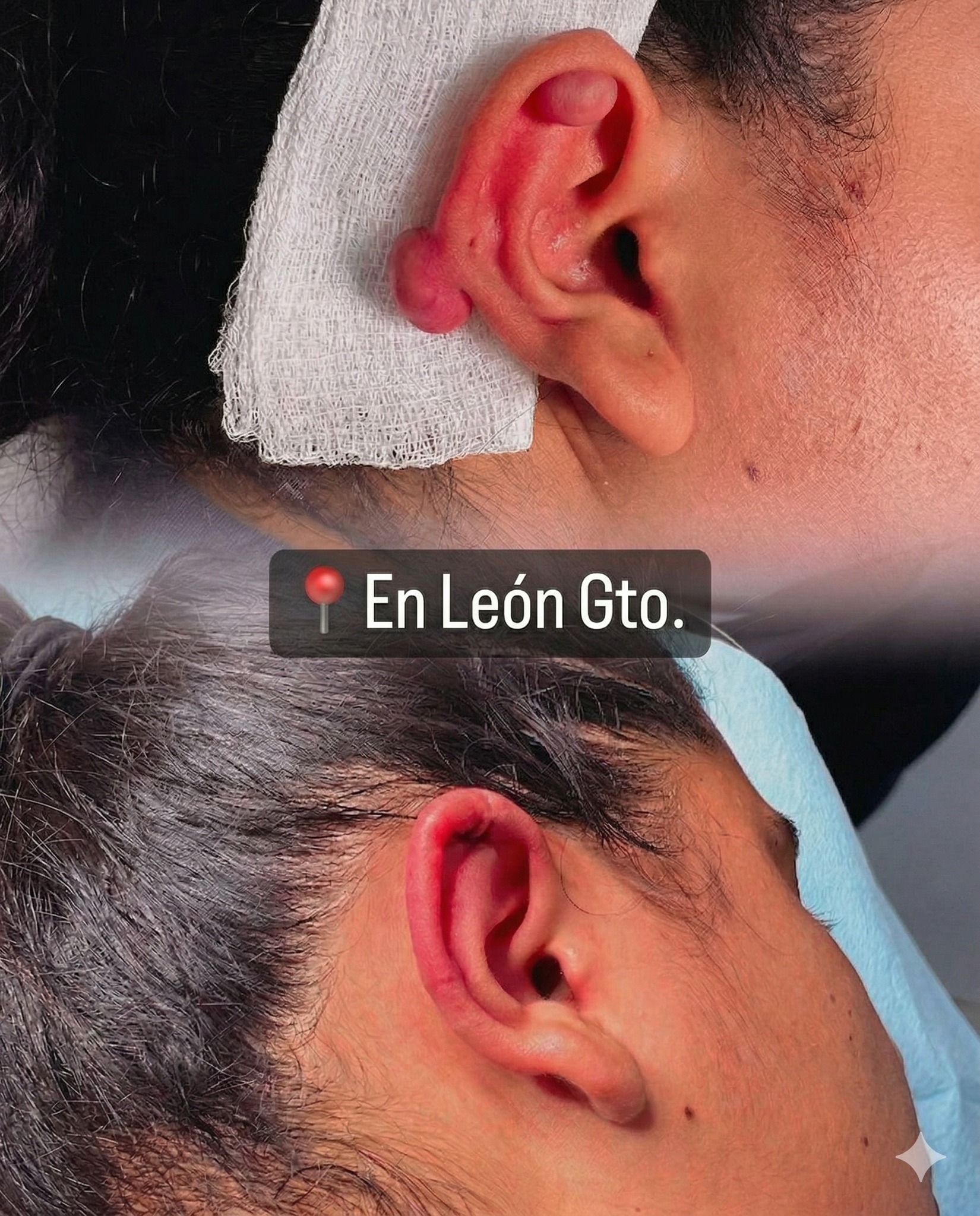 Dr Tattoo Clinical Studio Facebook ad: Atención León, Gto.