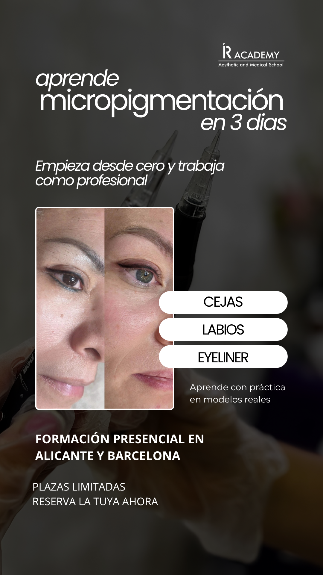 IR Group Academy. Academia de Estética Avanzada Facebook ad
