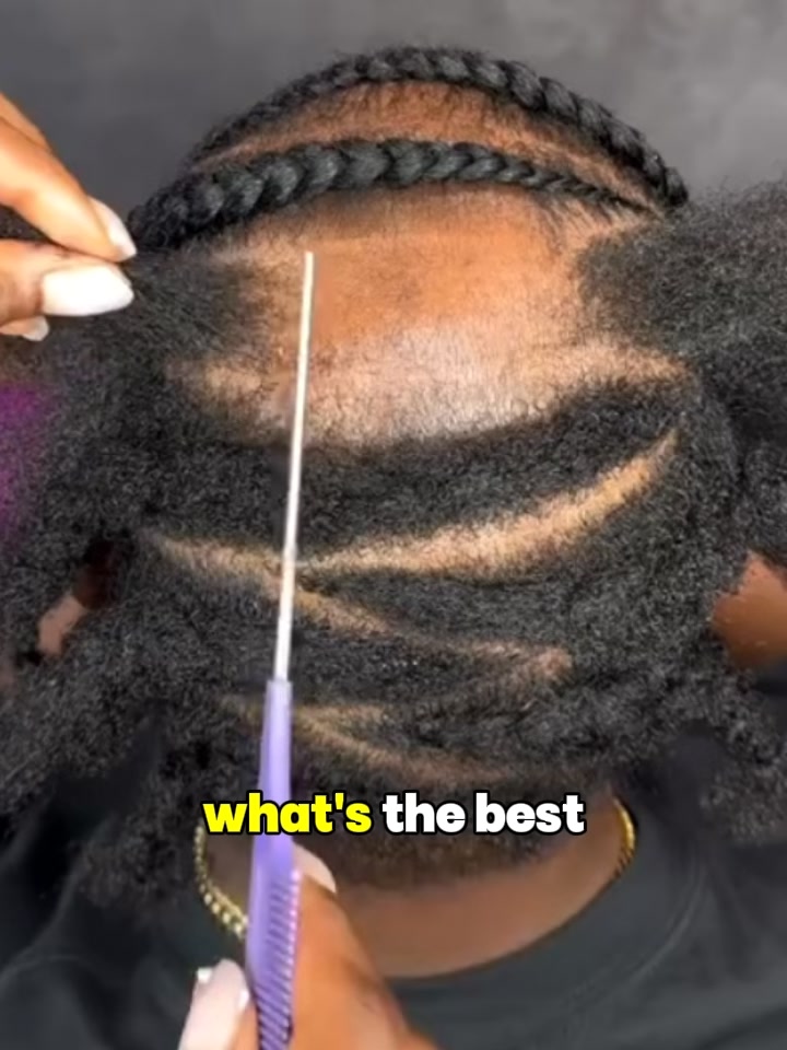 OrréNaturals Facebook ad: From Spreading Bald Spot… to Stopping It Cold.