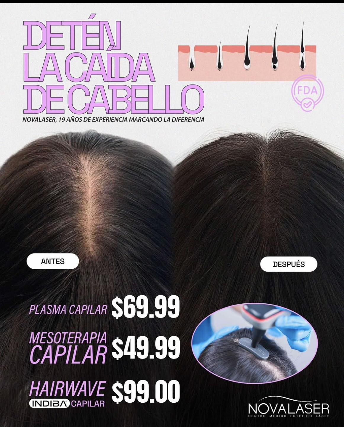 Novalaser Facebook ad