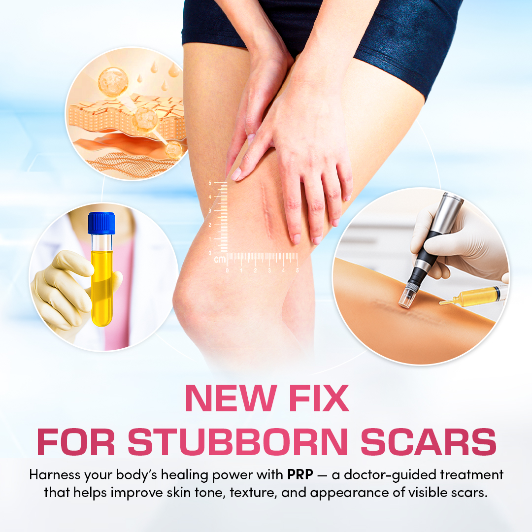Melia Beauty Facebook ad: Say Goodbye to Scars for Only โฑ999!