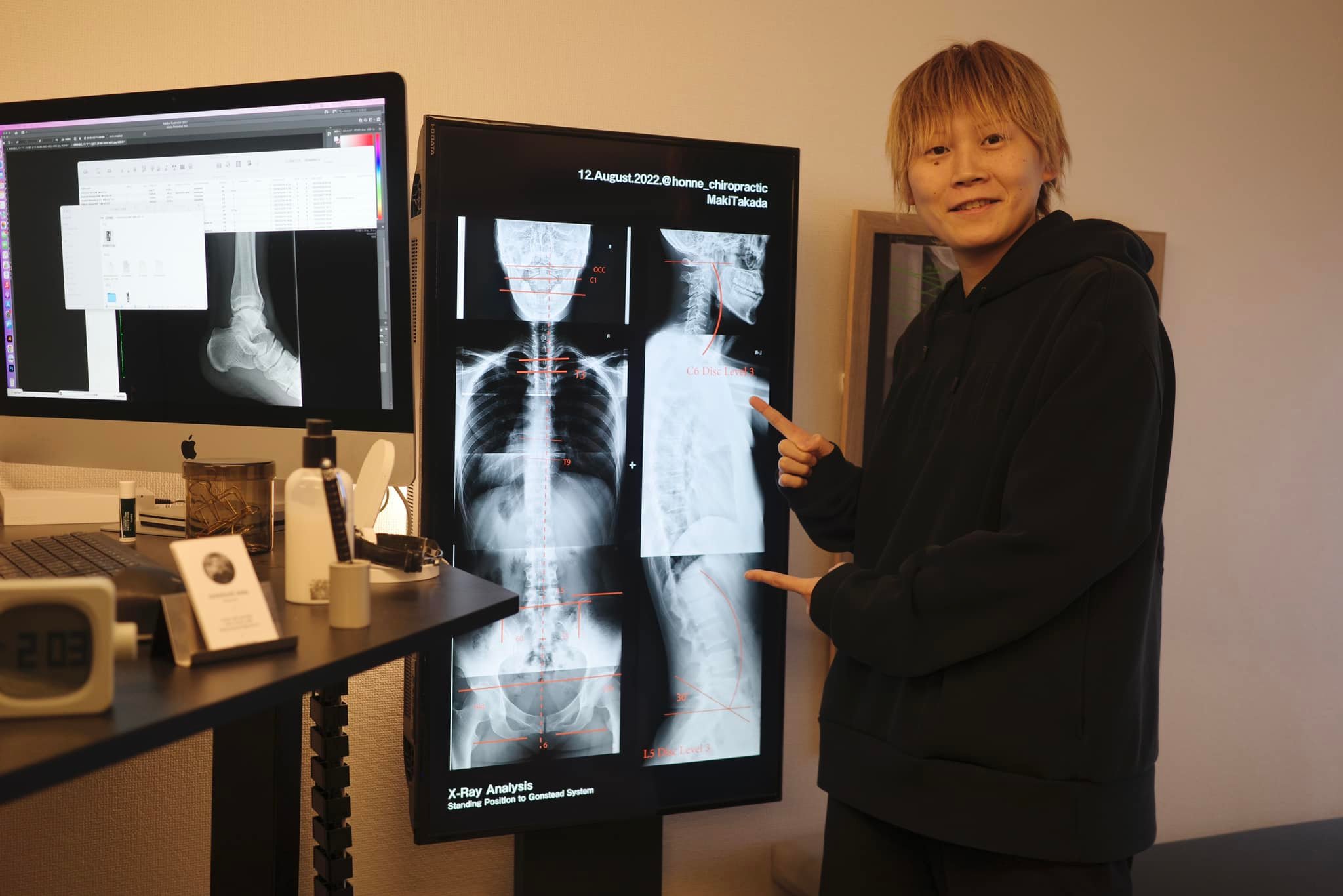 表参道・身体のホンネカイロプラクティック・gonstead chiropractor Facebook ad
