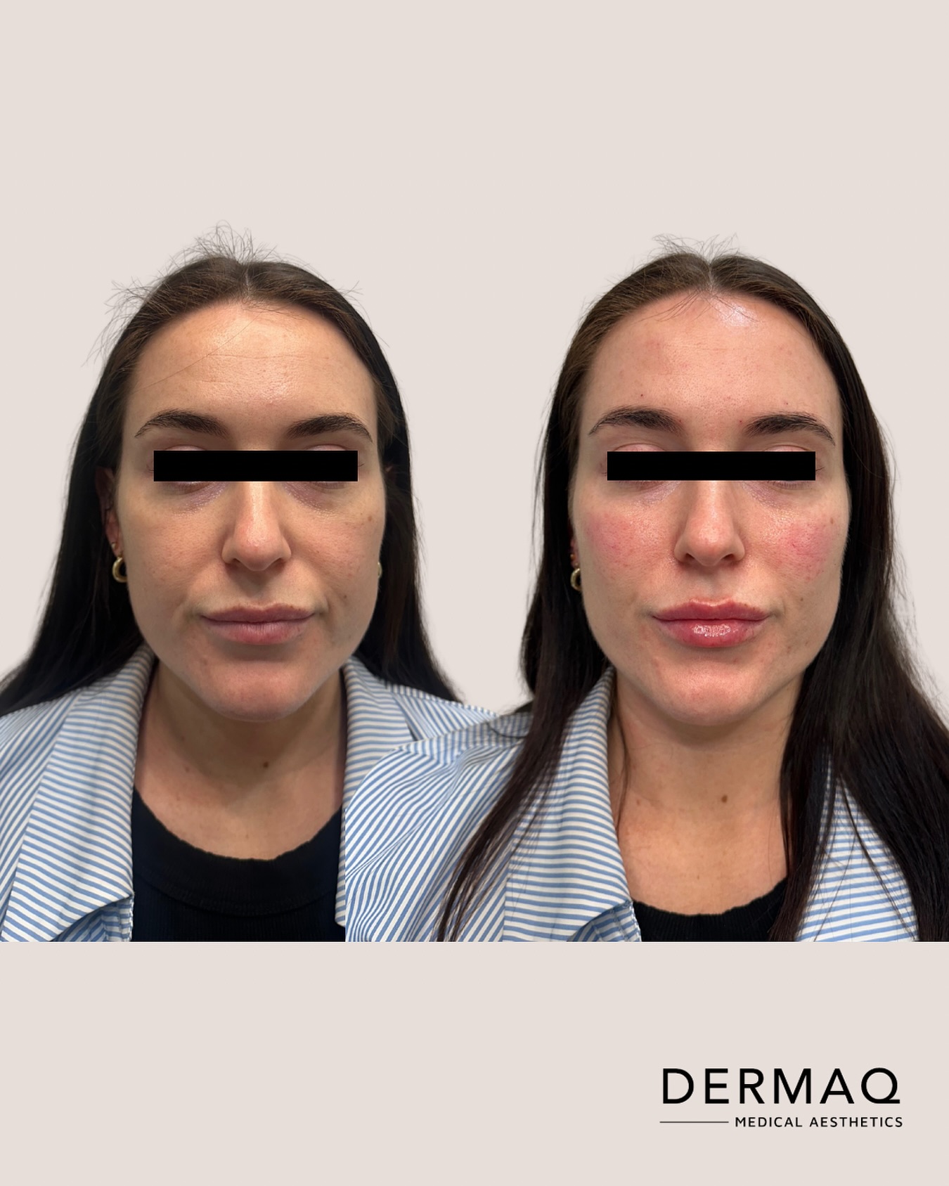 Dermaq Aesthetics Facebook ad: Dermaq offers personalised, multimodal treatments designed…
