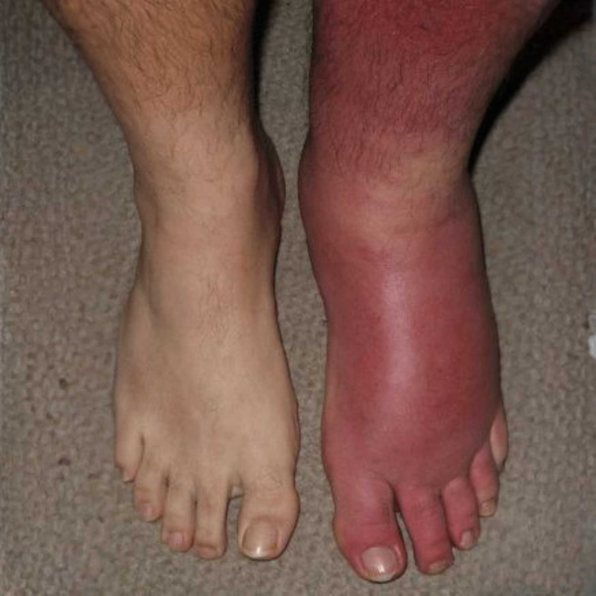 Tina Cooper Facebook ad: My feet were so swollen by evening I couldn’t get my shoes…