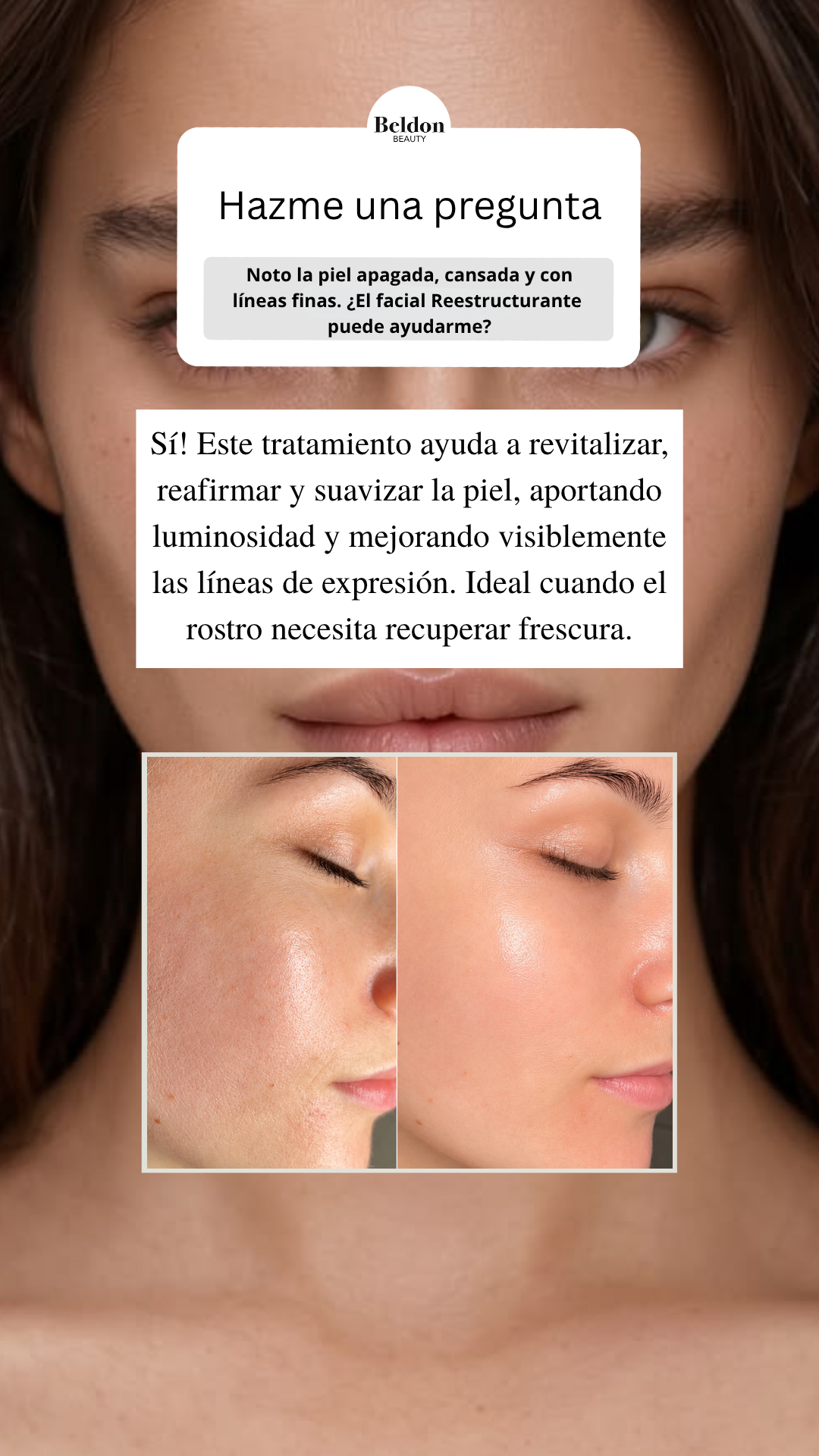 Beldon Beauty Facebook ad: Devuélvele vida a tu piel