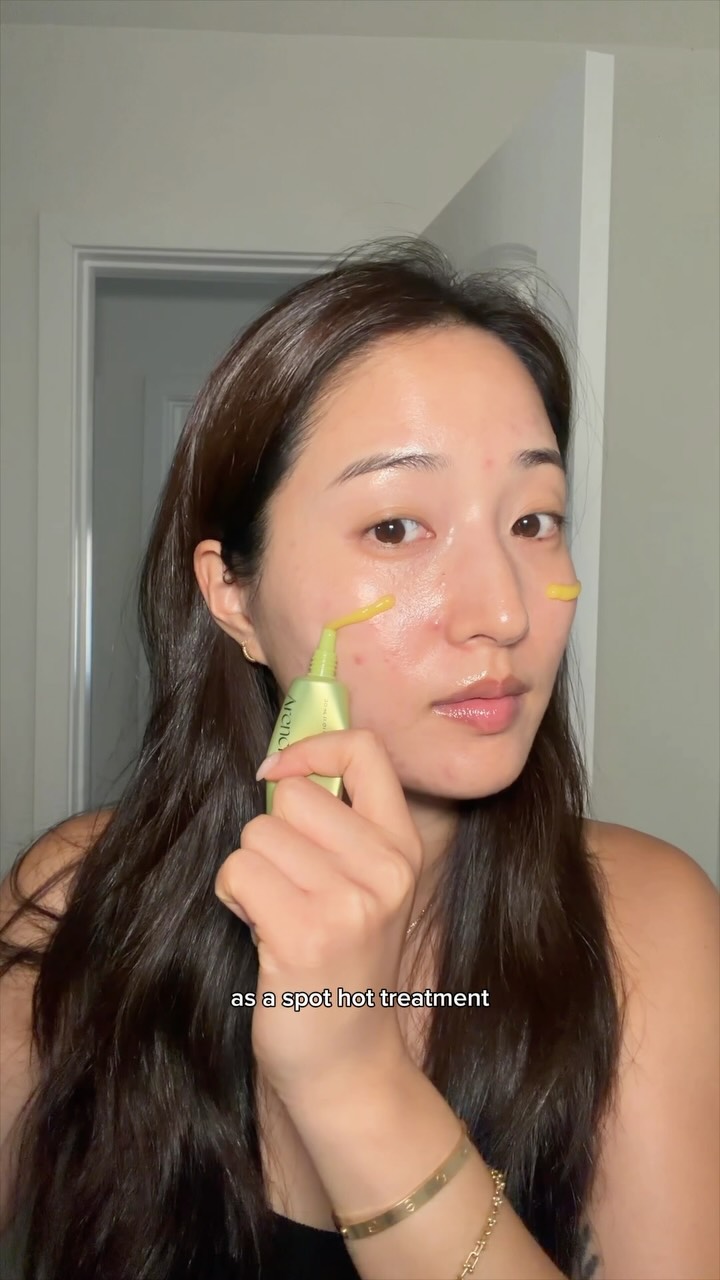 Arencia Global Facebook ad: My acne flared up so bad recently….