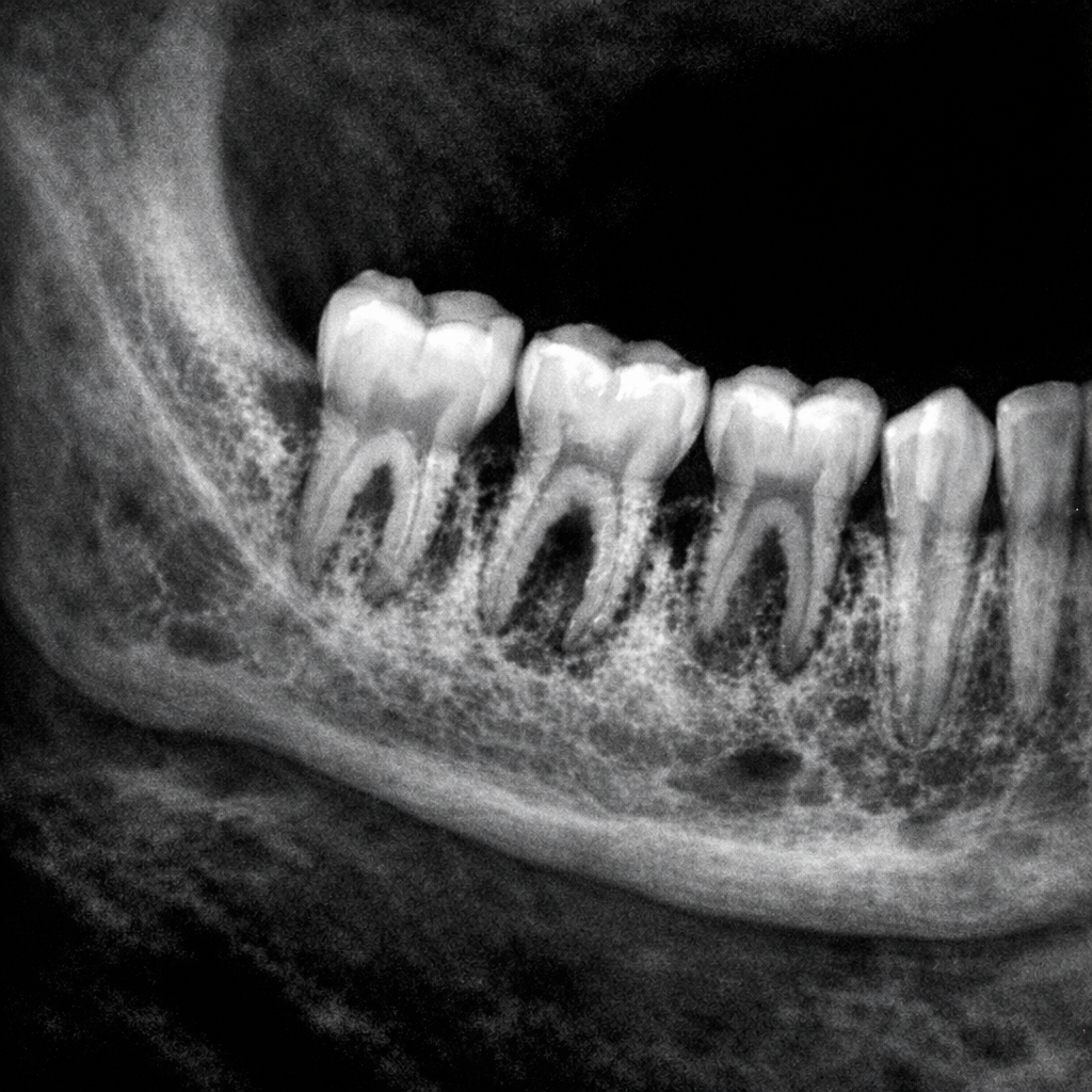Dr. Richard Torres Facebook ad: Real Reason For Gum Recession