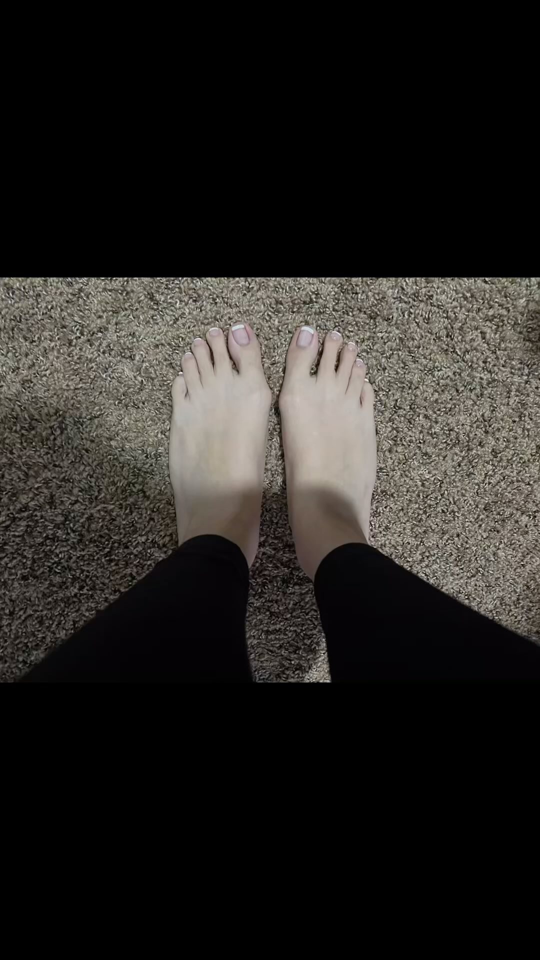 Foot First Podiatry Centers Facebook ad: Sometimes cross over or under the second toes…