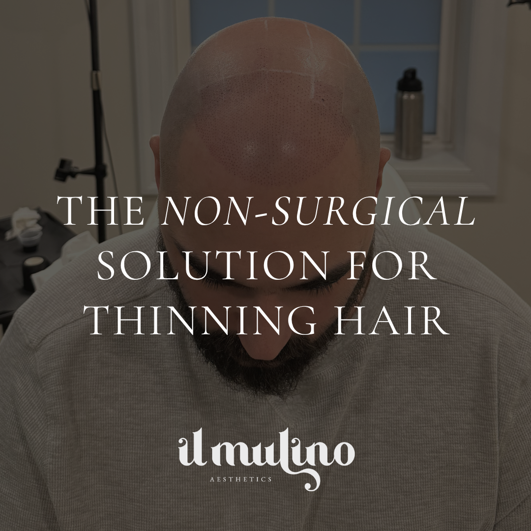 Il Mulino - Aesthetics Facebook ad: Scalp Micropigmentation (SMP) is the most natural-looking…