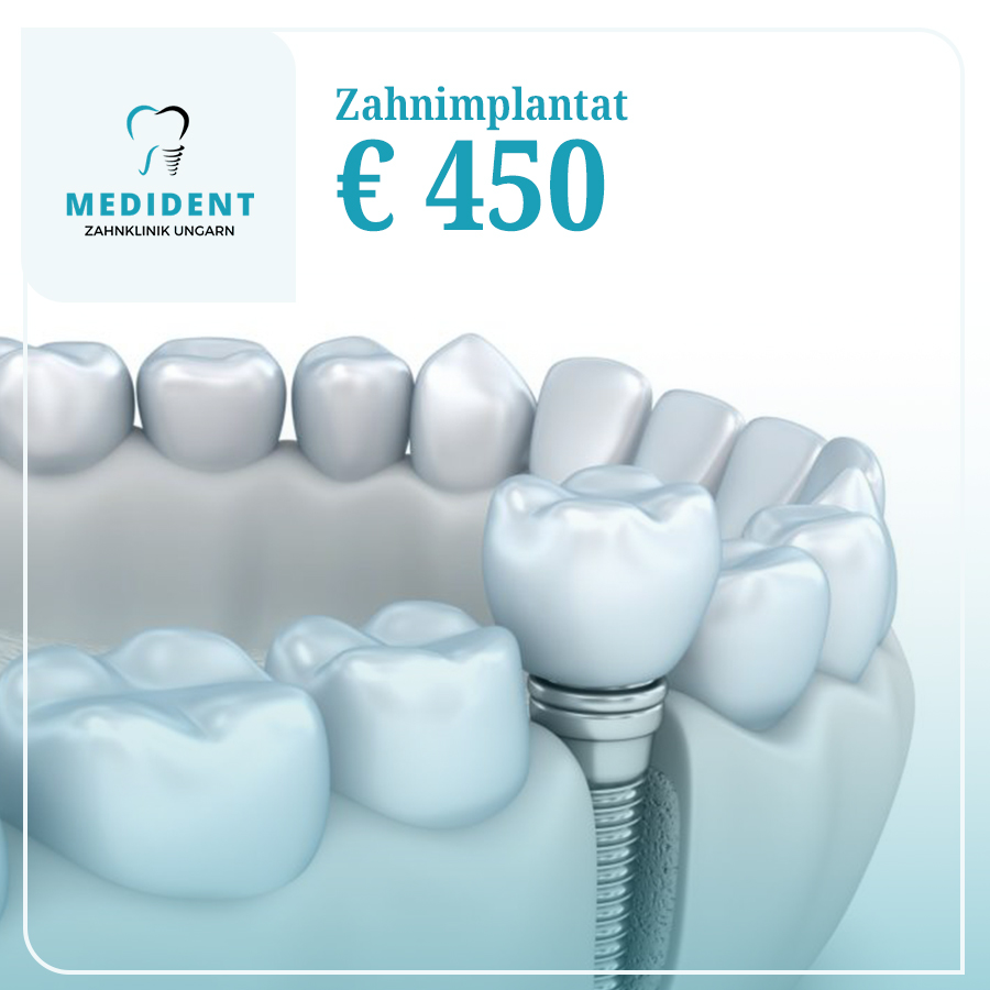 Medident Zahnklinik Facebook ad: Medident Zahnklinik in Ungarn.