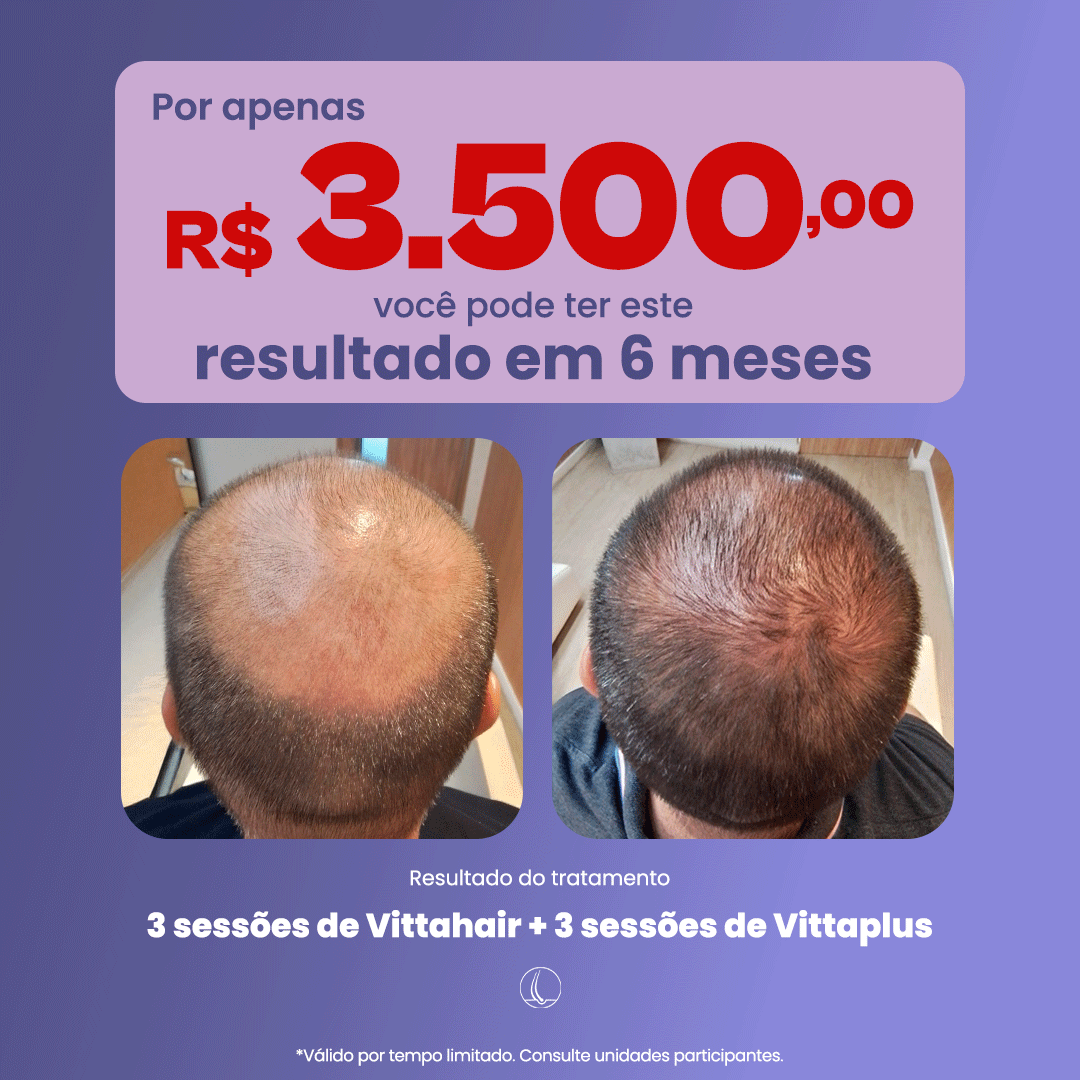 Mais Cabello Saúde Capilar Facebook ad: Este resultado pode ser o seu!
