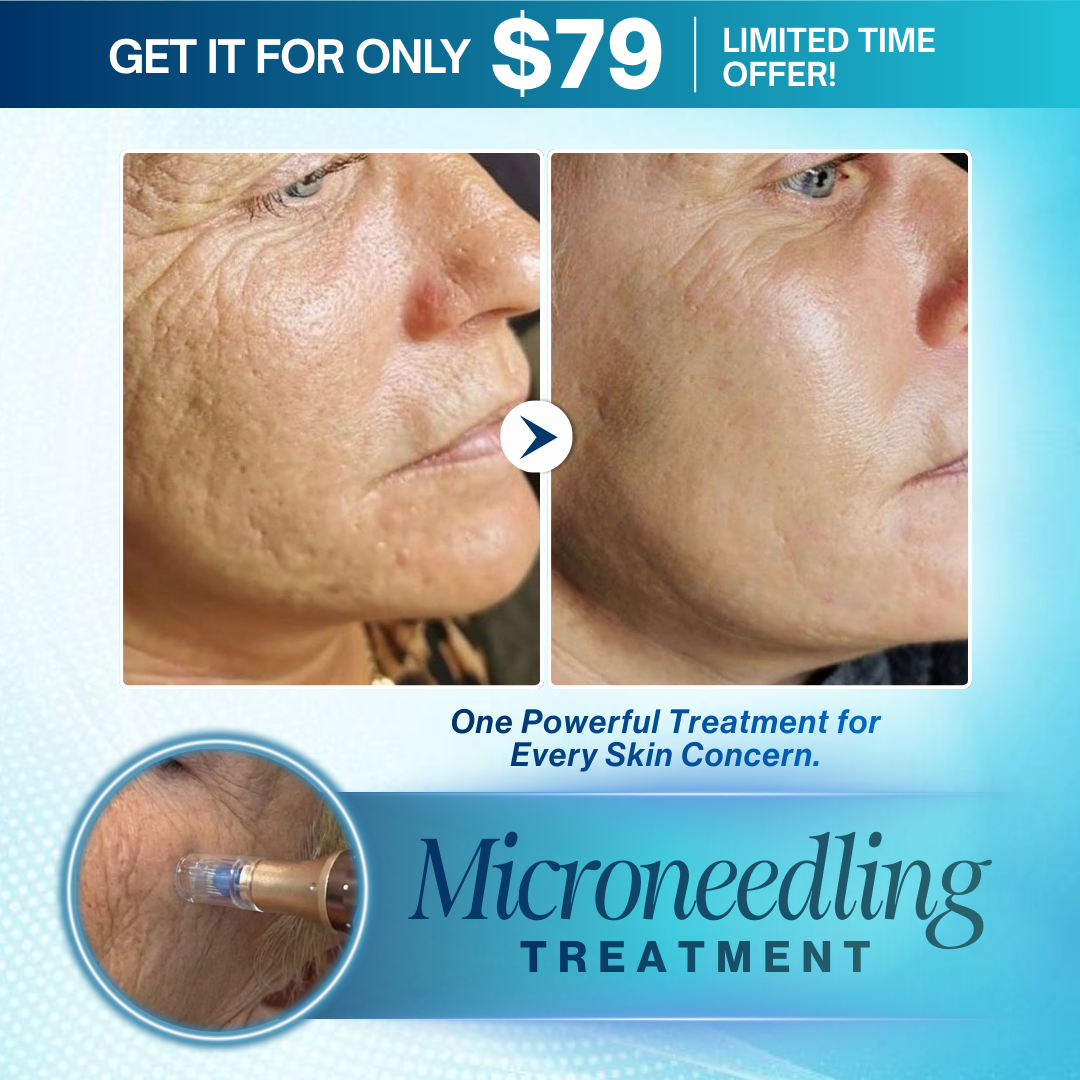 I Love Skin Treatments Facebook ad