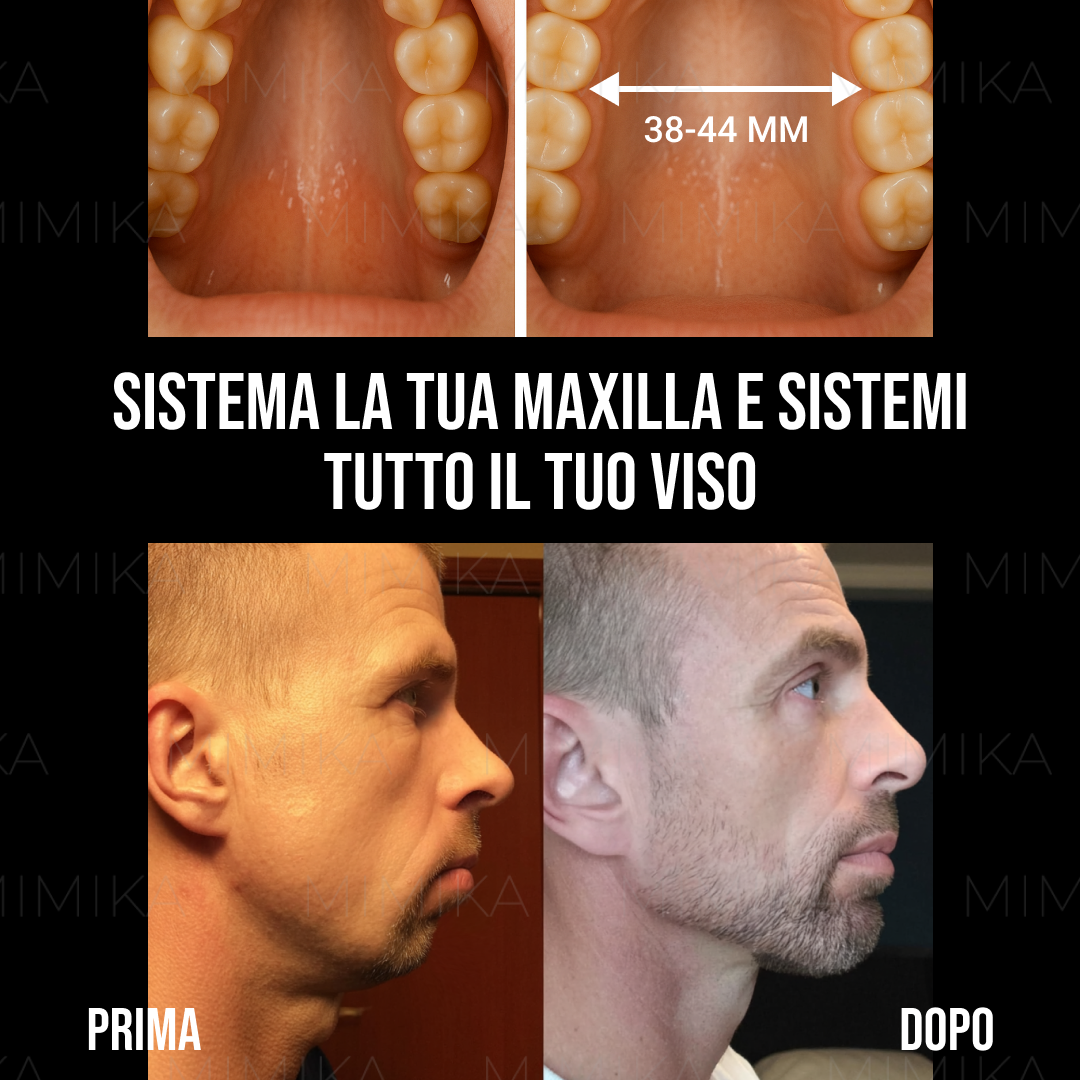 Mark Mewing Facebook ad
