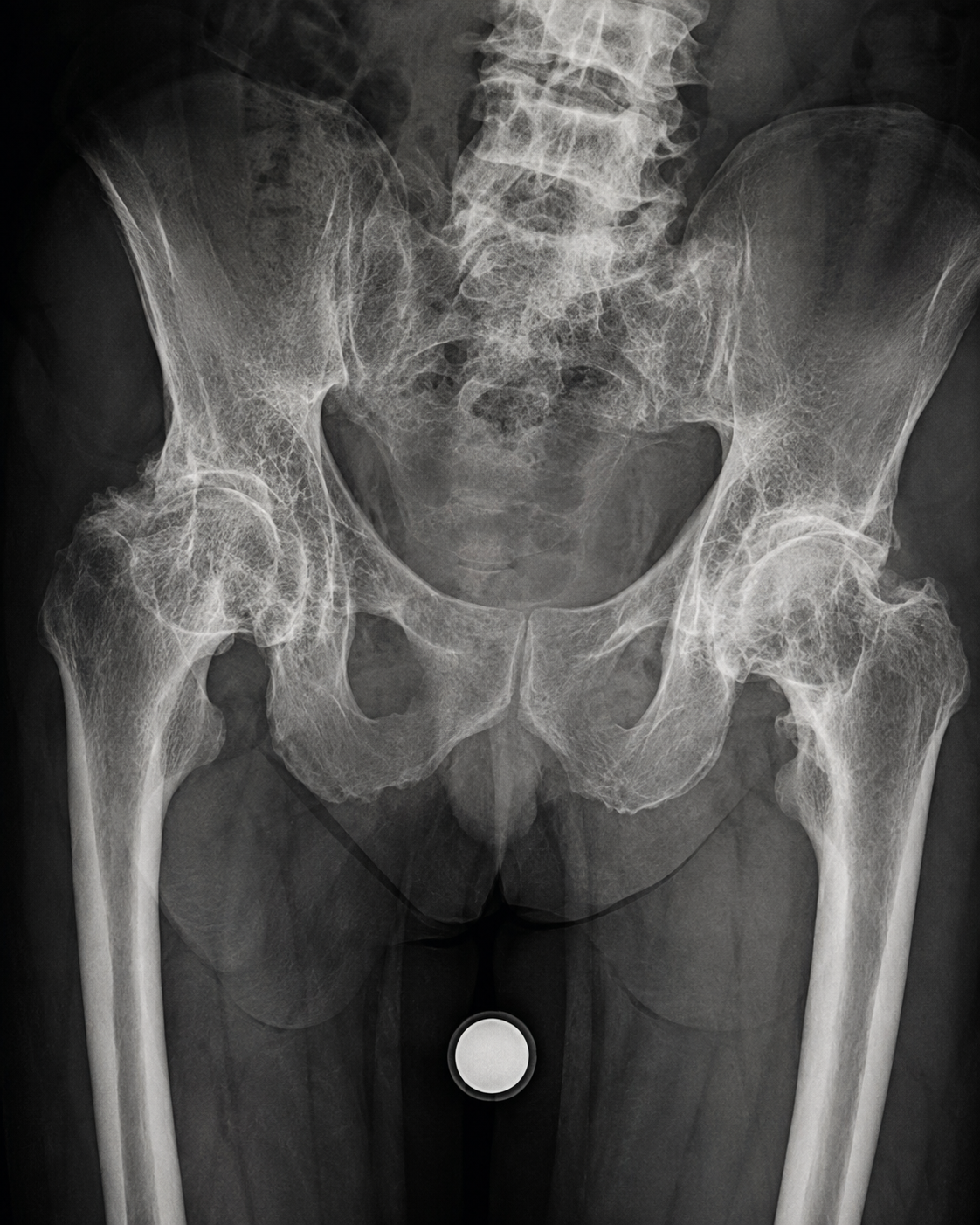 Everyday Arthritis Blog Facebook ad