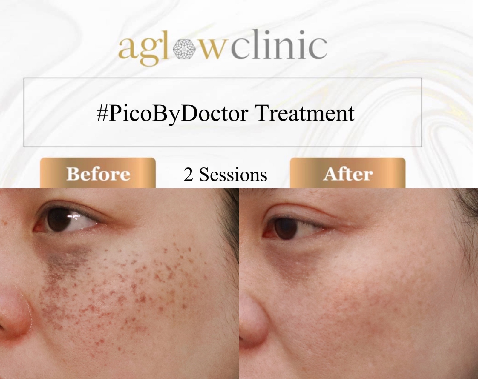 Aglow Clinic Facebook ad