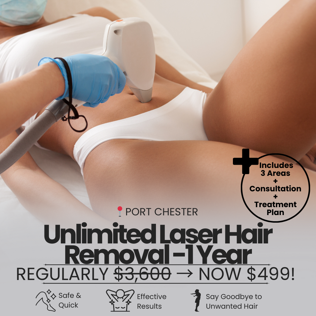Sense Medical Spa Facebook ad: Unlimited Laser Hair Removal for 1 Year NOW $499
