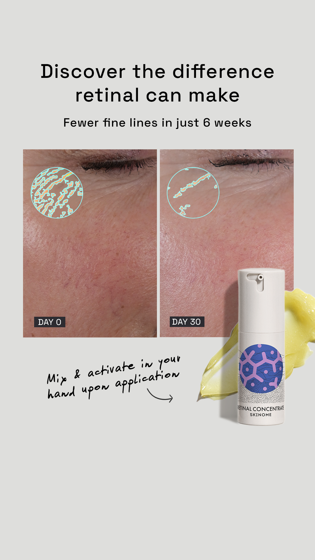 Skinome Facebook ad