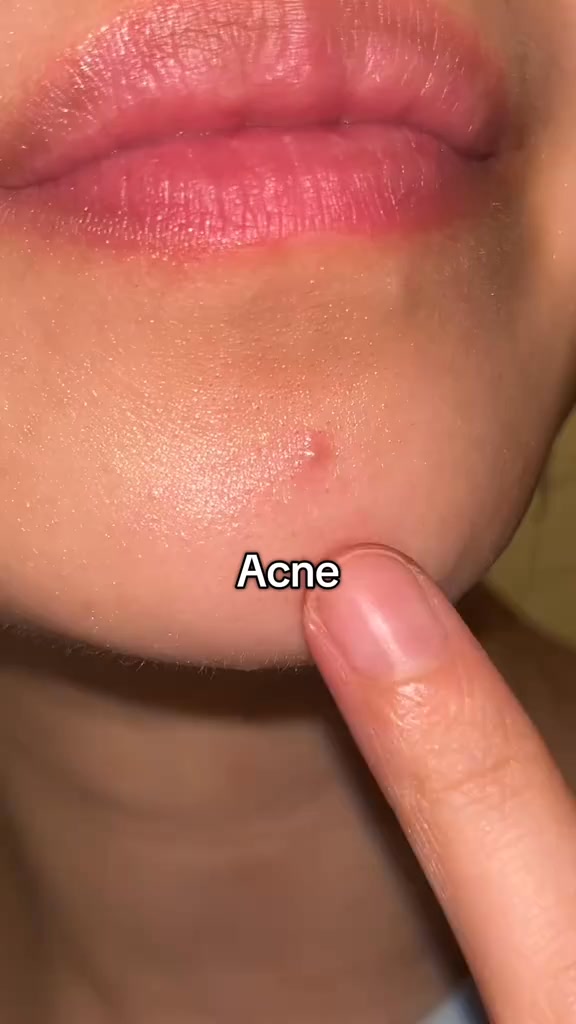 Arencia Global Facebook ad: Amazon No.1 Cleanser