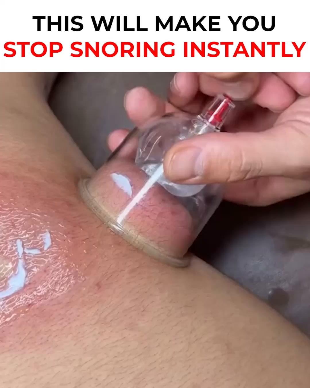 Honex Facebook ad: Fix Snoring & Sleepless Nights
