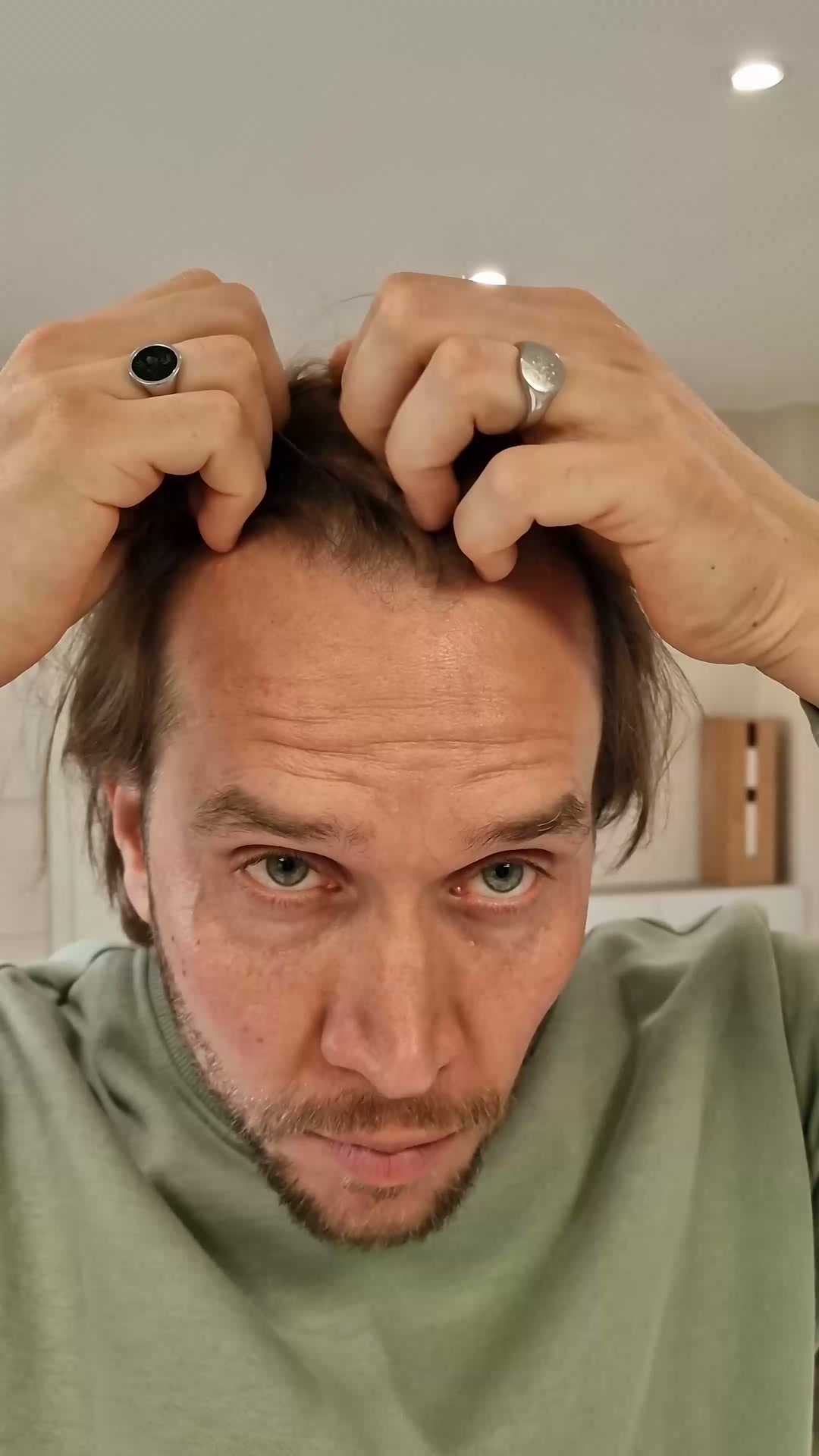 Alpecin Brasil Facebook ad: Cabelo afinando depois dos 30? Existe um biohack.