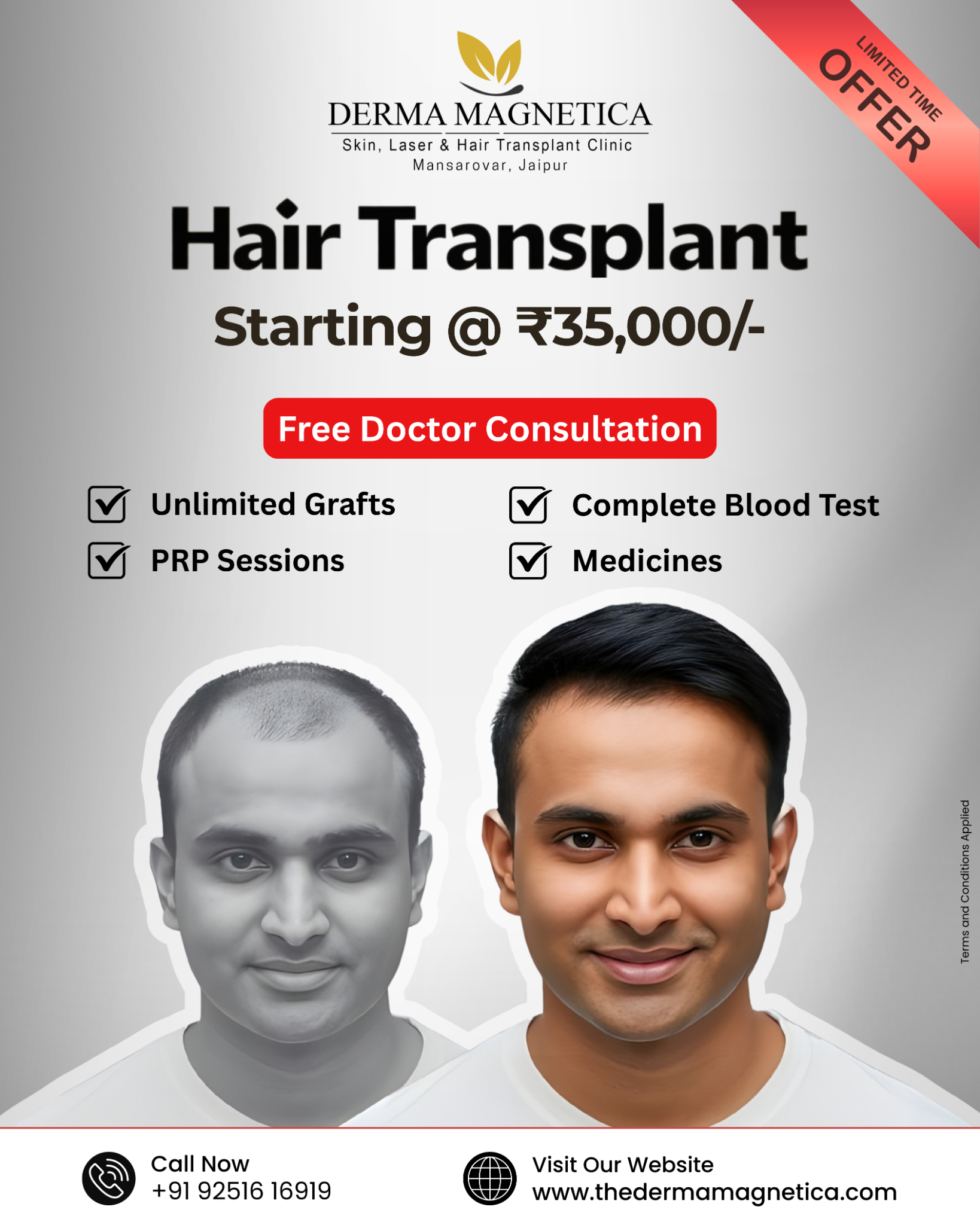 Derma Magnetica Clinic Facebook ad: Hair Transplant Start at Just Rs. 35,000