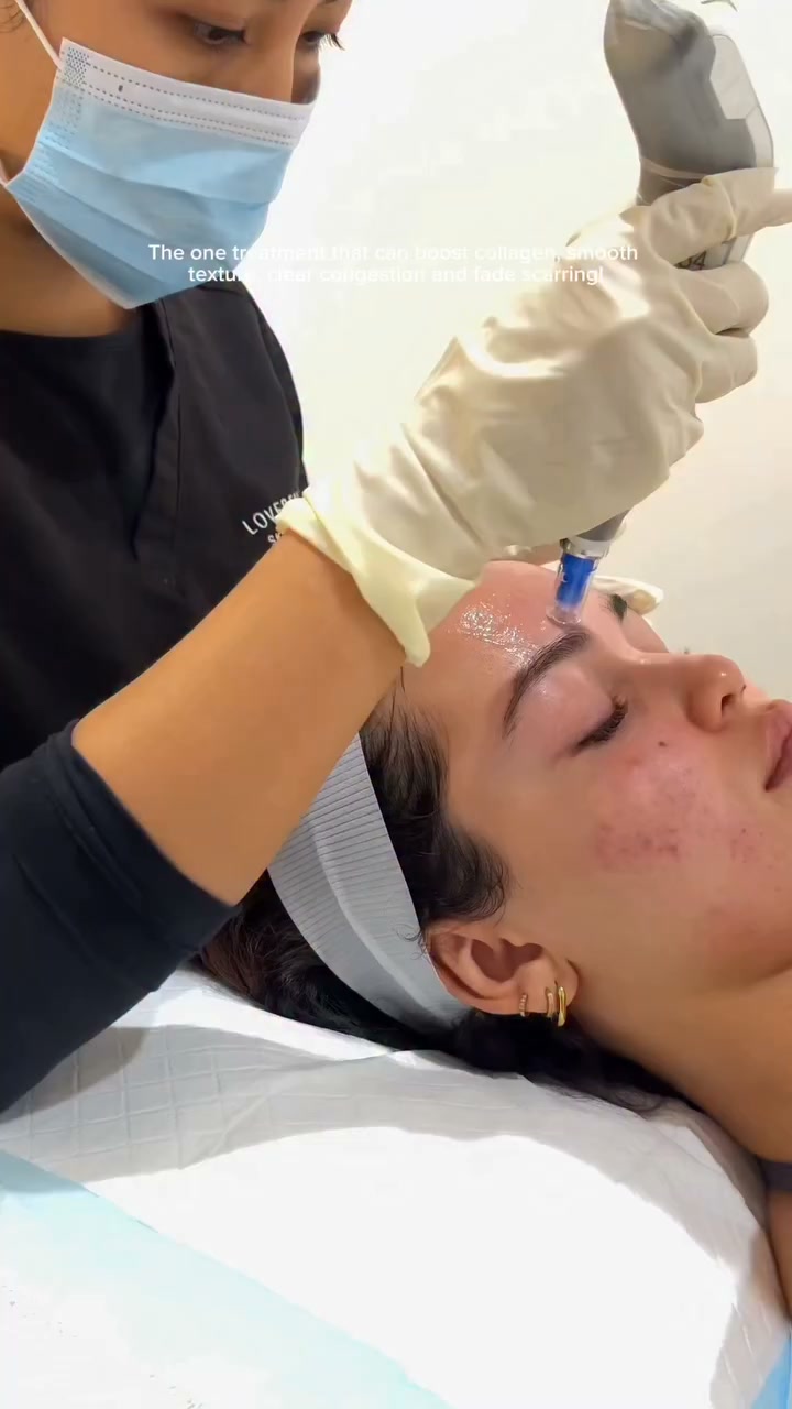 LoveBeauty Skin Clinic Facebook ad: ABIA Skin Clinic of the Year 2025
