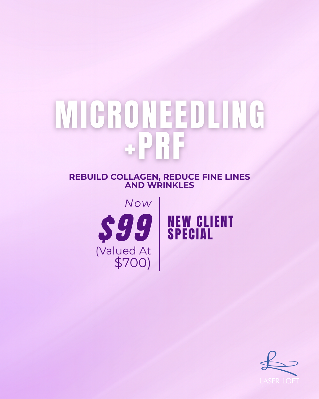 Laser Loft Facebook ad