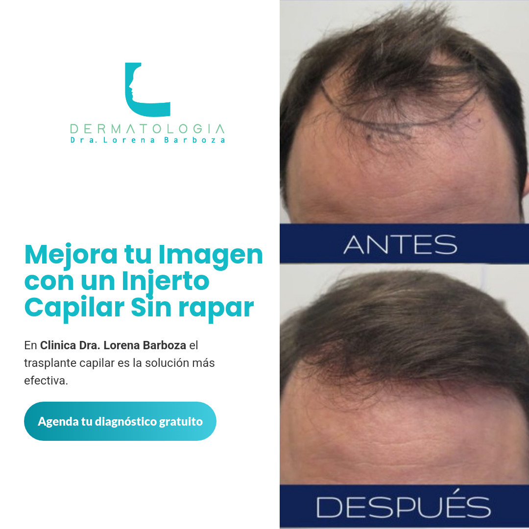Dermalorenabarboza Facebook ad: Recupera tu cabello perdido y tu confianza