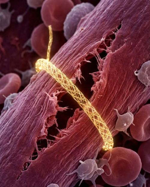 The Maggots Plague Facebook ad: Natürliche Linderung in wenigen Wochen