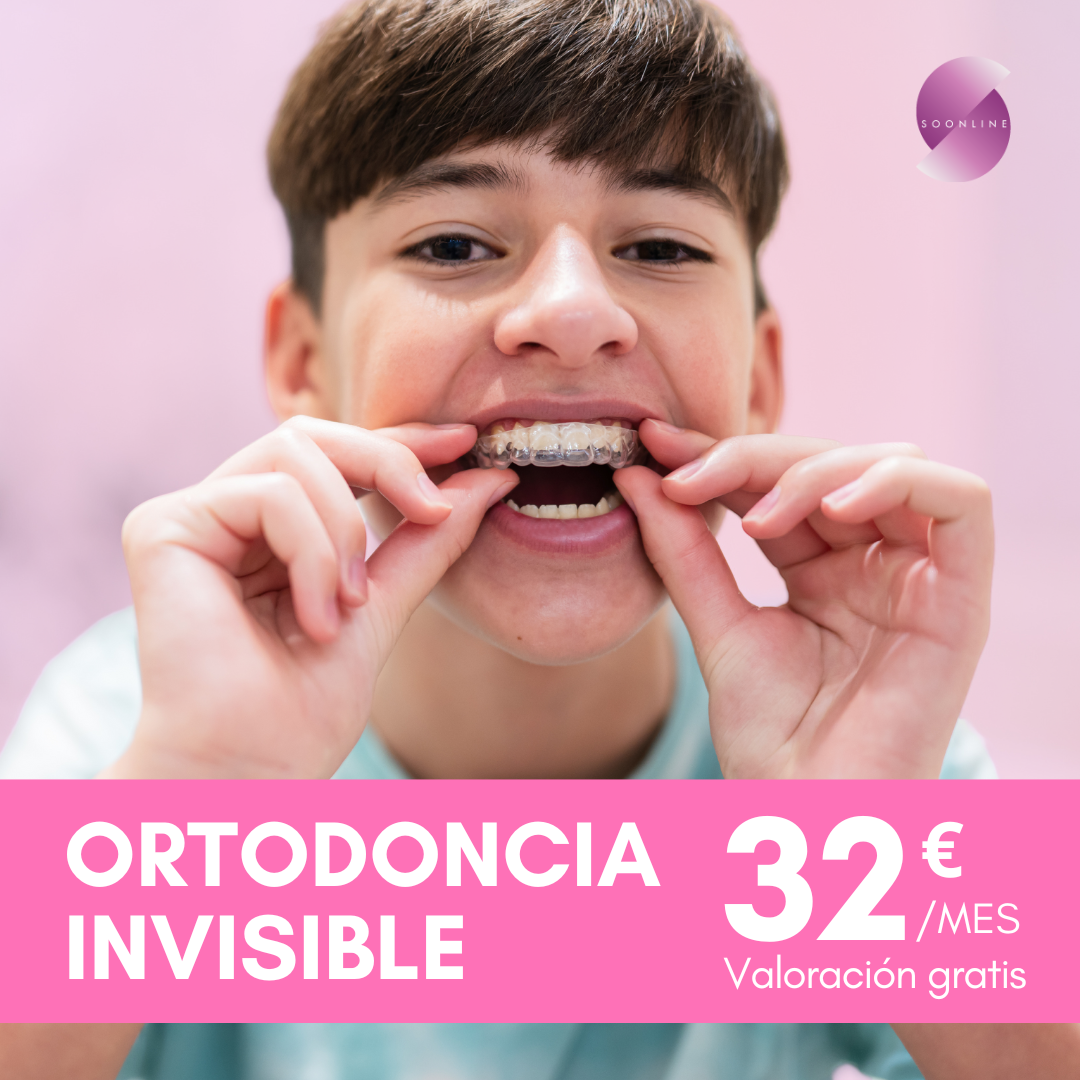 Soonline.es Facebook ad: Ortodoncia invisible