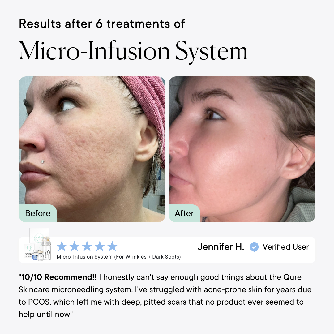 Qure Skincare Facebook ad