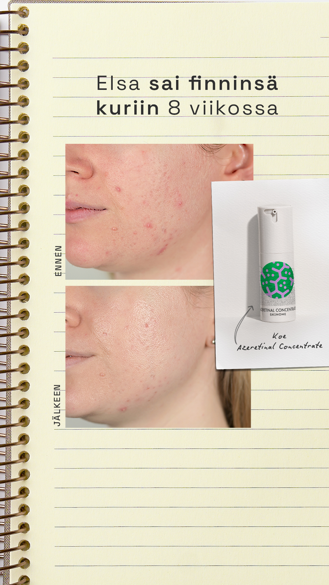 Skinome Facebook ad