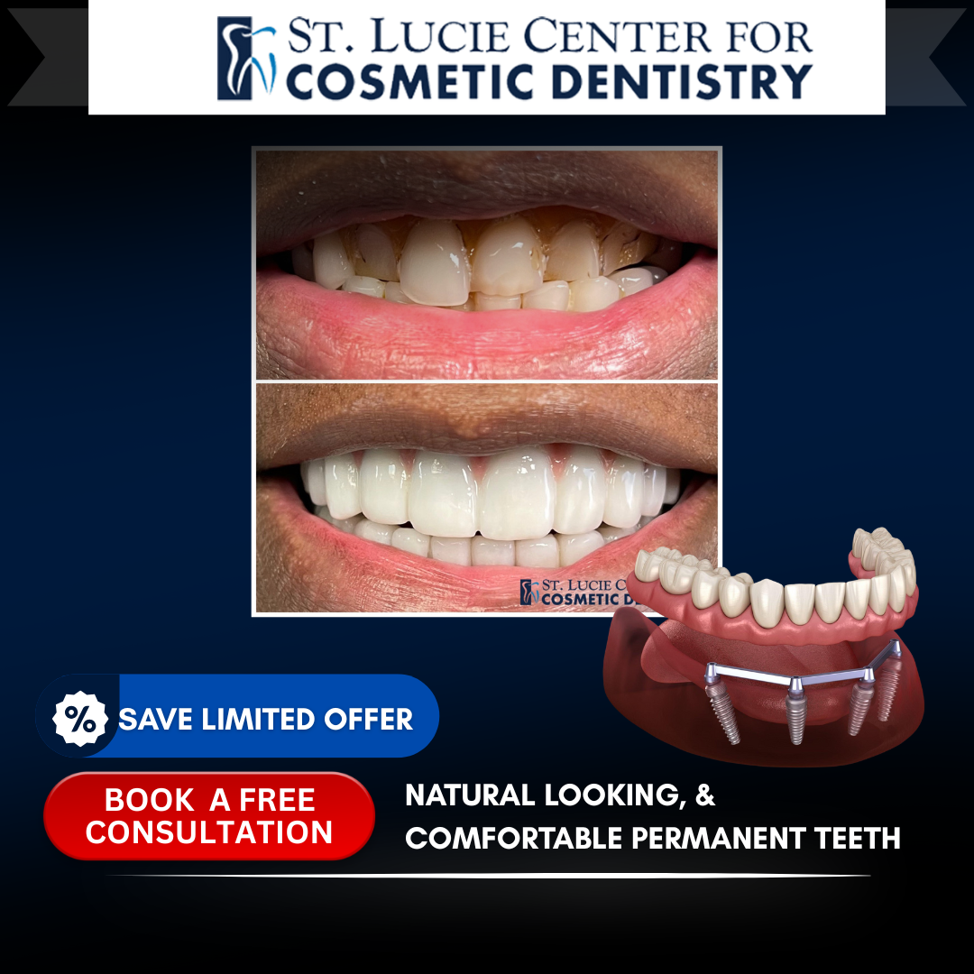 St. Lucie Center for Cosmetic Dentistry Facebook ad: Implants That Feel Real