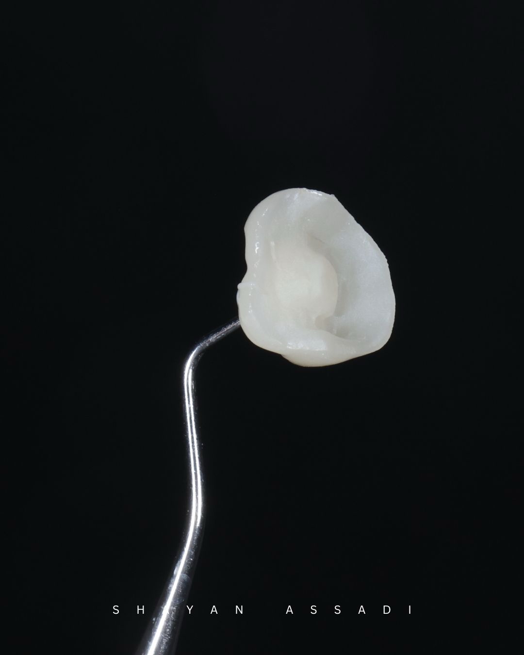 Dr. Shayan Assadi Facebook ad: In my experience, digital dentistry stands on four…
