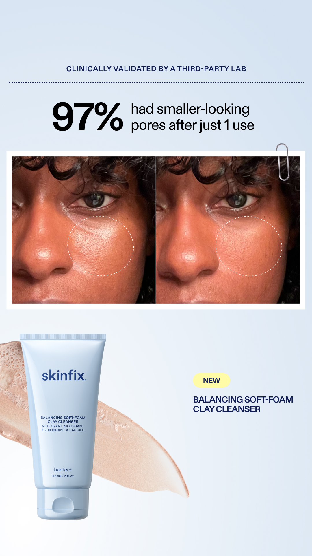 Skinfix Inc. Facebook ad