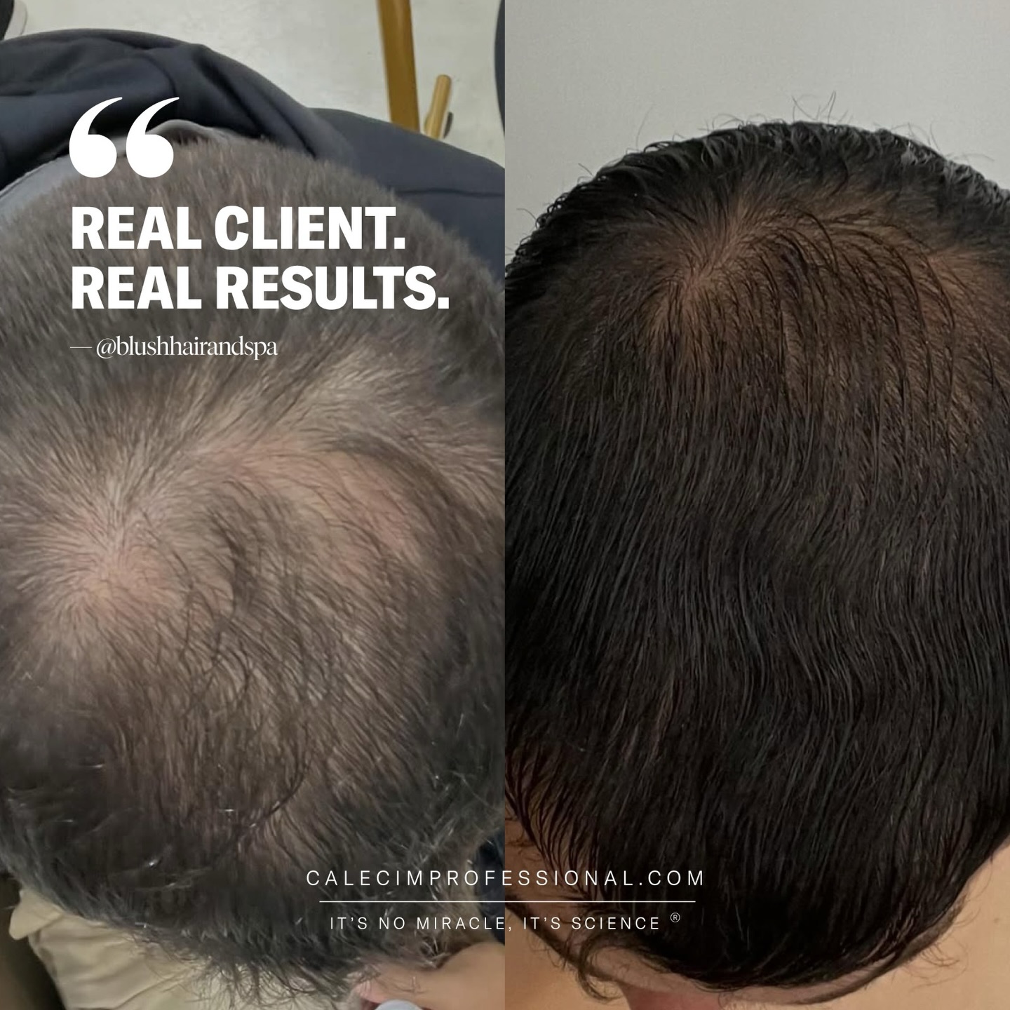 Calecim Professional Facebook ad