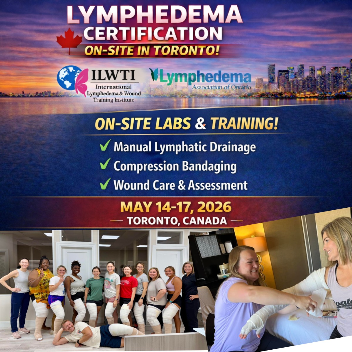 International Lymphedema & Wound Training Institute Facebook ad: CLWT HYBRID COURSE TORONTO