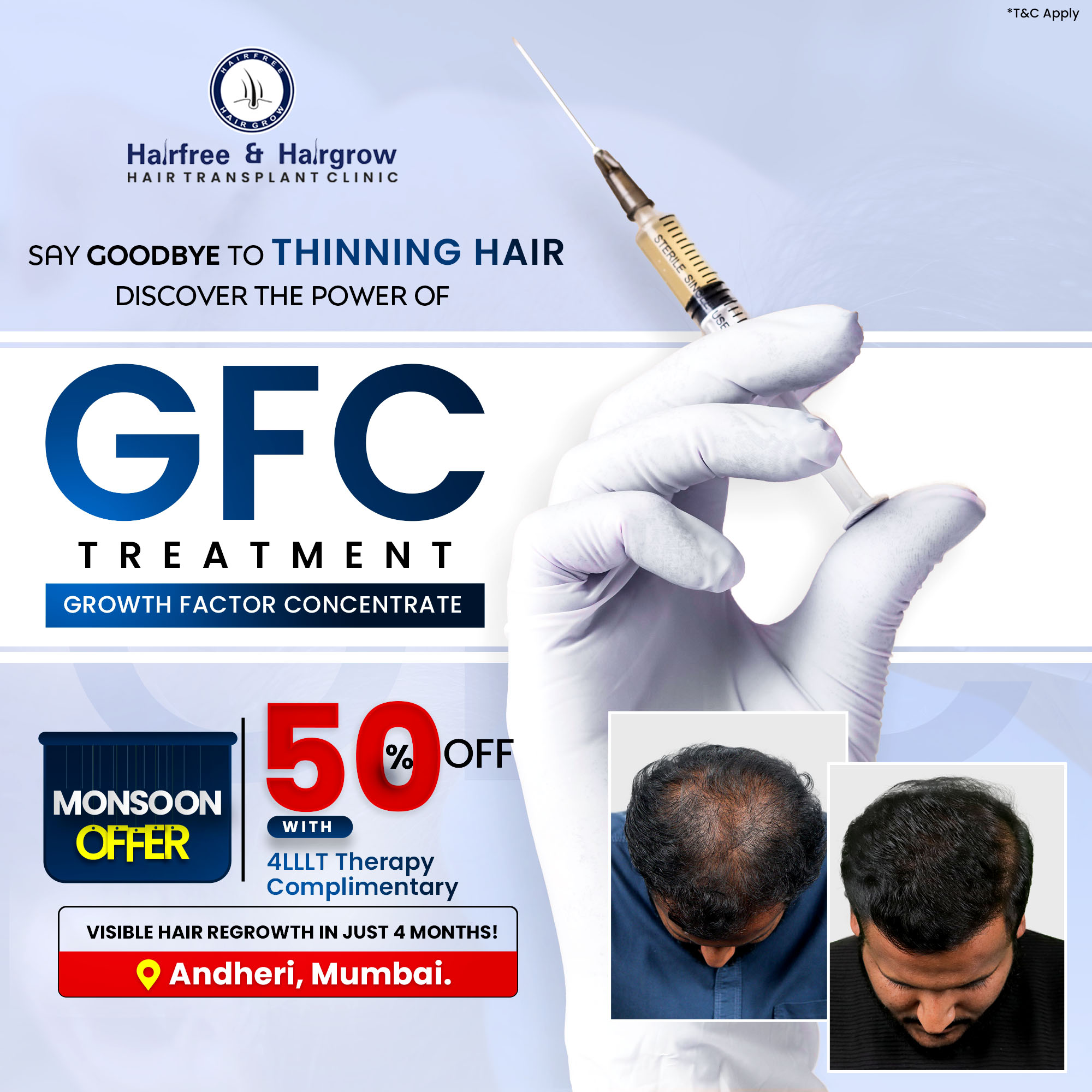 Hairfree Hairgrow Clinic Facebook ad