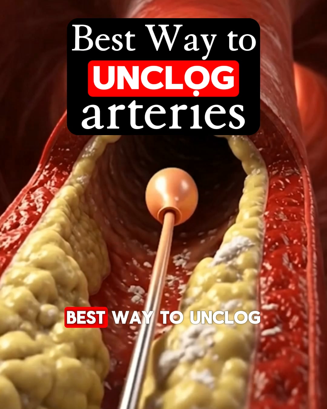 The Health Community Facebook ad: Plaque In Your Arteries? Stop Doing This.