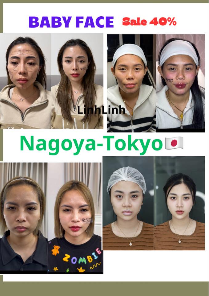Linh Linh Clinic Facebook ad: 𝟐𝟎𝟐𝟔- 𝐔̛𝐮 đ𝐚̃𝐢 𝐅𝐈𝐋𝐋𝐄𝐑-𝐁𝐎𝐓𝐎𝐗 𝐒𝐀𝐋𝐄…