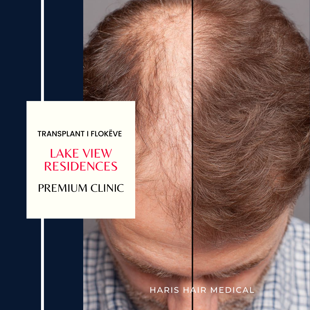 Haris Hair Medical Facebook ad