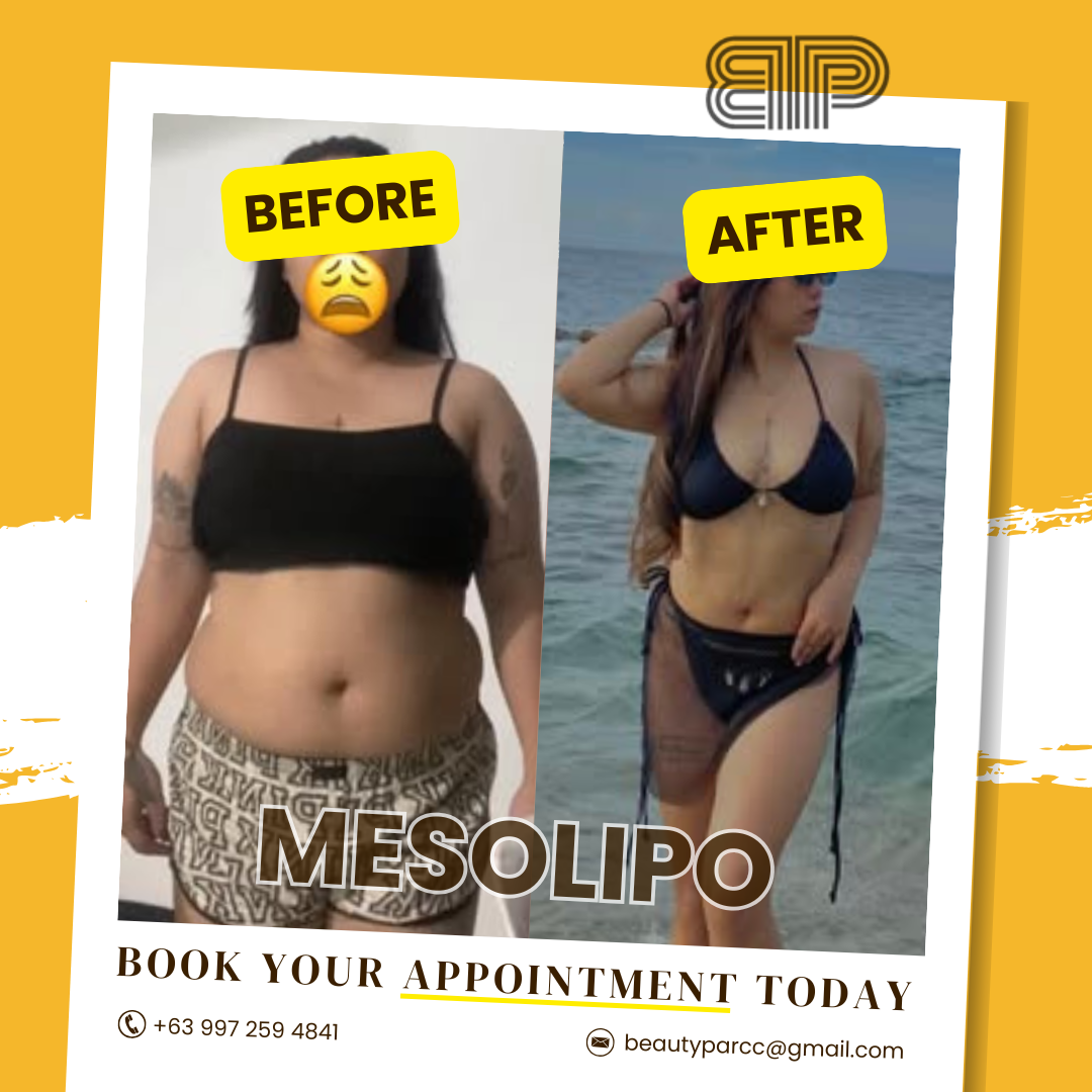 Beauty Parć Caloocan Facebook ad: 𝐆𝐥𝐨𝐰 𝐔𝐩, 𝐒𝐥𝐢𝐦 𝐃𝐨𝐰𝐧, 𝐚𝐧𝐝 𝐄𝐧𝐡𝐚𝐧𝐜𝐞…