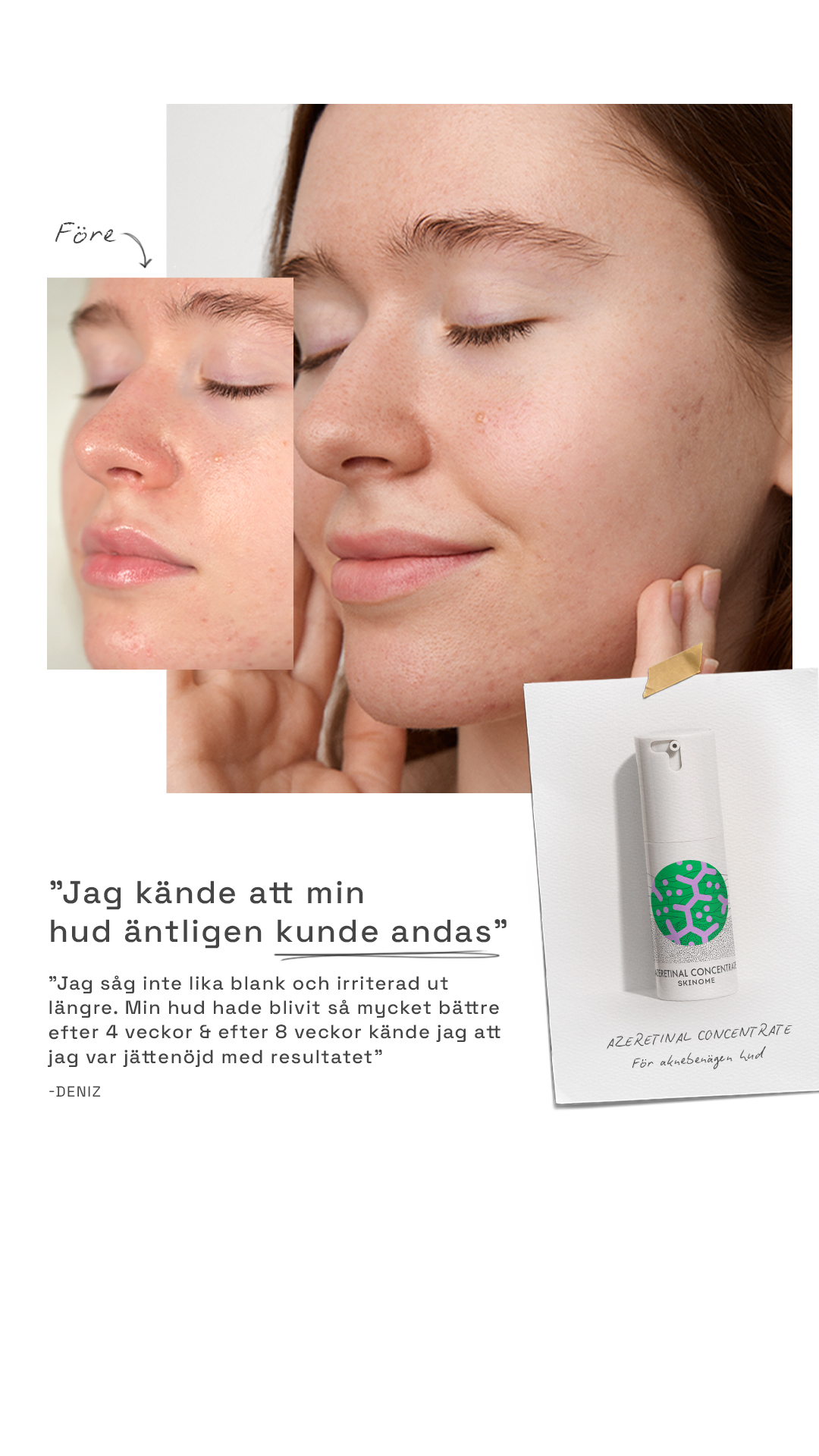 Skinome Facebook ad